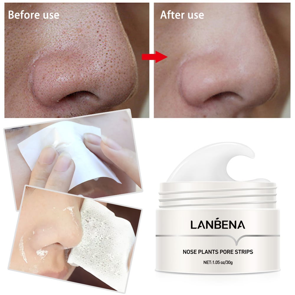 LANBENA Plants Pore Strips